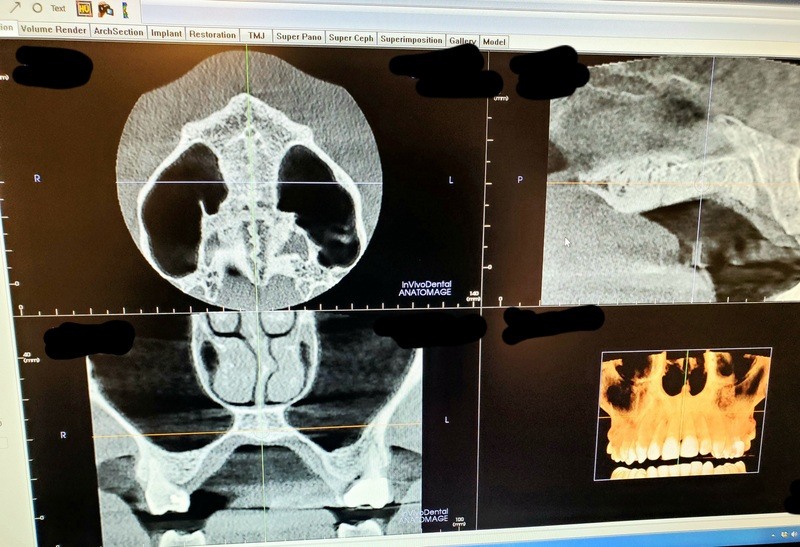 Cone Beam Imaging